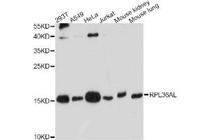 Western blot analysis of extracts of various cell lines, using RPL36AL antibody. (RPL36AL anticorps)
