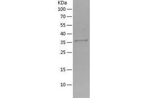 Western Blotting (WB) image for Collagen Triple Helix Repeat Containing 1 (CTHRC1) (AA 31-136) protein (His-IF2DI Tag) (ABIN7122441)