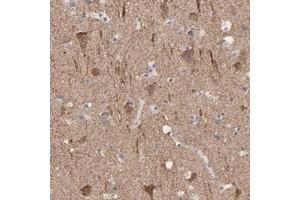 Immunohistochemical staining of human cerebral cortex with CNTN3 polyclonal antibody  shows strong cytoplasmic positivity in neuronal cells at 1:50-1:200 dilution. (CNTN3 anticorps)