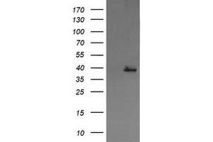 Image no. 1 for anti-Mitogen-Activated Protein Kinase Kinase 3 (MAP2K3) antibody (ABIN1499416) (MAP2K3 anticorps)