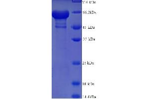 SDS-PAGE (SDS) image for Keratin 14 (KRT14) (AA 1-472), (full length) protein (His tag) (ABIN5713594)