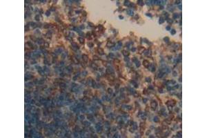 Used in DAB staining on fromalin fixed paraffin- embedded Kidney tissue (CD72 anticorps  (AA 143-345))