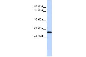 WB Suggested Anti-SOD2 Antibody Titration: 0. (SOD2 anticorps  (N-Term))