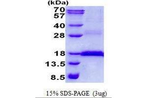 Figure annotation denotes ug of protein loaded and % gel used. (CD3 epsilon Protein (CD3E))