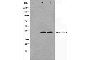 Western blot analysis on COS7 and HuvEc cell lysate using TRADD Antibody. (TRADD anticorps)