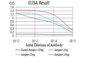 Black line: Control Antigen (100 ng), Purple line: Antigen(10 ng), Blue line: Antigen (50 ng), Red line: Antigen (100 ng), (LRP1 anticorps  (AA 20-155))