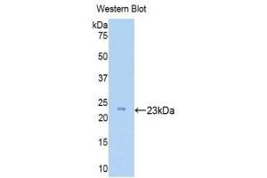 Western Blotting (WB) image for anti-Zyxin (ZYX) (AA 384-572) antibody (ABIN1175612) (ZYX anticorps  (AA 384-572))
