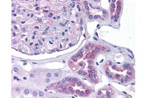 CCL2 antibody was used for immunohistochemistry at a concentration of 4-8 ug/ml. (CCL2 anticorps  (Middle Region))