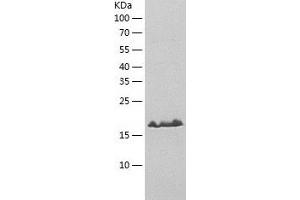 Western Blotting (WB) image for B9 Protein Domain 2 (B9D2) (AA 1-175) protein (His tag) (ABIN7121968) (B9D2 Protein (AA 1-175) (His tag))