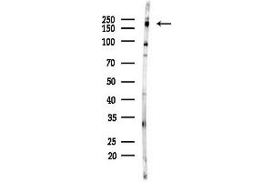 anti-Lymphocyte Antigen 75 (LY75) (Internal Region) antibody