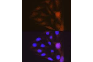 Immunofluorescence analysis of U-2 OS cells using Musashi-1 (MSI1) Rabbit mAb (ABIN7268700) at dilution of 1:100 (40x lens). (MSI1 anticorps)