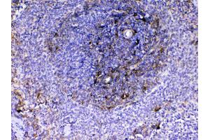 IHC analysis of VCAM1 using anti-VCAM1 antibody .