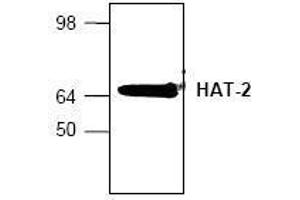 Image no. 1 for anti-MYST Histone Acetyltransferase 2 (MYST2) (N-Term) antibody (ABIN155154) (MYST2 anticorps  (N-Term))