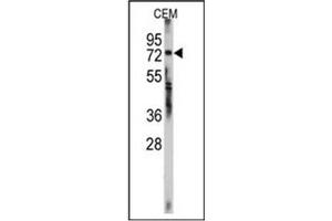 Image no. 1 for anti-Zinc Finger Protein 219 (ZNF219) (AA 660-690), (C-Term) antibody (ABIN357353) (ZNF219 anticorps  (C-Term))