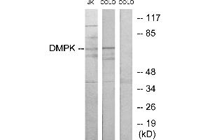 Western blot analysis of extracts from Jurkat cells and COLO205 cells, using DMPK antibody. (DMPK anticorps)