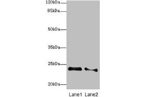Western blot All lanes: RRAS2 antibody at 2. (RRAS2 anticorps  (AA 1-204))