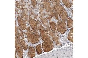 Immunohistochemical staining of human stomach with SLC39A2 polyclonal antibody  shows strong positivity in chief cells.