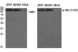 Western Blot (WB) analysis of specific cells using Phospho-JAK1 (Y1022) Polyclonal Antibody. (JAK1 anticorps  (pTyr1022))