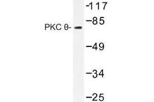 Image no. 1 for anti-Protein Kinase C, theta (PRKCQ) antibody (ABIN317883) (PKC theta anticorps)