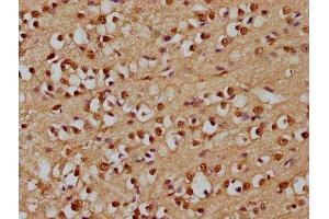 IHC image of ABIN7167791 diluted at 1:300 and staining in paraffin-embedded human brain tissue performed on a Leica BondTM system. (p130 anticorps  (AA 417-616))