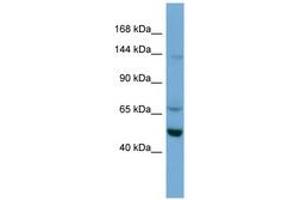 Image no. 1 for anti-Tripartite Motif Containing 66 (TRIM66) (AA 359-408) antibody (ABIN6745662) (TRIM66 anticorps  (AA 359-408))