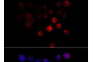 Immunofluorescence analysis of 293T cells using TOM1 Polyclonal Antibody at dilution of 1:100 (40x lens). (TOM1 anticorps)