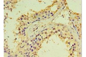Immunohistochemistry of paraffin-embedded human testis tissue using ABIN7144984 at dilution of 1:100