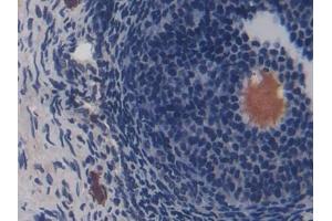 DAB staining on IHC-P; Samples: Rat Ovary Tissue (CD8B anticorps  (AA 21-208))
