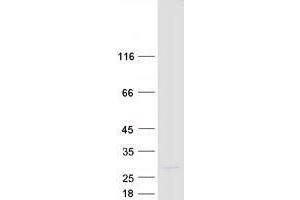 Validation with Western Blot
