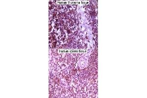 Immunohistochemical analysis of paraffin-embedded lymphocyte of human thymoma and human spleen tissue showing cytoplasmic localization using MAP2K4 monoclonal antibody, clone 2D10D8,4G11B2  with DAB staining.