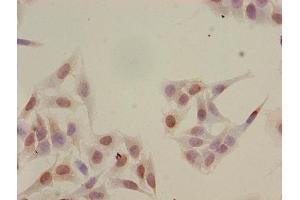 Immunocytochemistry analysis of Hela cells using ABIN7139165 at dilution of 1:100