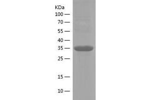 Integrin alpha-L (ITGAL) (AA 1112-1170) protein (His-IF2DI Tag)