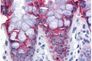 Human Colon: Formalin-Fixed, Paraffin-Embedded (FFPE)