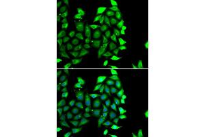 Immunofluorescence analysis of MCF-7 cells using IKZF3 antibody (ABIN4904027). (IKZF3 anticorps)