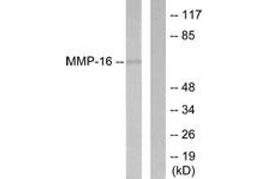 Western blot analysis of extracts from HepG2 cells, using MMP-16 Antibody. (MMP16 anticorps  (AA 551-600))