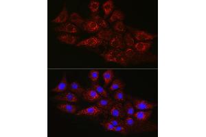 Immunofluorescence analysis of NIH/3T3 cells using CPT2 Rabbit pAb (ABIN6129249, ABIN6138983, ABIN6138984 and ABIN6216045) at dilution of 1:100 (40x lens).