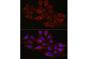 Immunofluorescence analysis of NIH/3T3 cells using CPT2 Rabbit pAb (ABIN6129249, ABIN6138983, ABIN6138984 and ABIN6216045) at dilution of 1:100 (40x lens). (CPT2 anticorps  (AA 1-180))