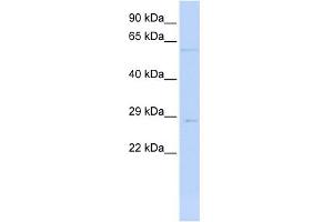 WB Suggested Anti-MRPL10 Antibody Titration: 0.
