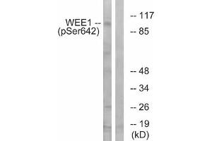 Western blot analysis of extracts from 293 cells treated with etoposide using WEE1 (Phospho-Ser642) Antibody. (WEE1 anticorps  (pSer642))