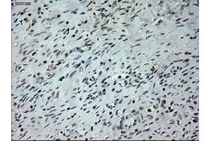Immunohistochemical staining of paraffin-embedded colon tissue using anti-PROM2mouse monoclonal antibody. (Prominin 2 anticorps)