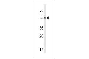 SRMS Antibody  (ABIN392109 and ABIN2841861) western blot analysis in HL-60 cell line lysates (35 μg/lane). (SRMS anticorps  (C-Term))