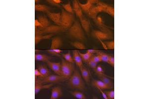 Immunofluorescence analysis of C6 cells using  antibody (ABIN7265552) at dilution of 1:100.