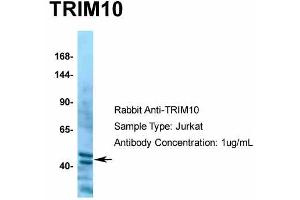 Host:  Rabbit  Target Name:  TRIM10  Sample Type:  Jurkat  Antibody Dilution:  1.