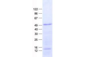 Validation with Western Blot