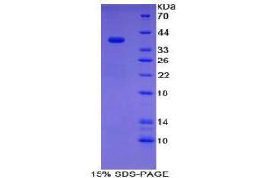 SDS-PAGE (SDS) image for Carboxypeptidase B1 (Tissue) (CPB1) (AA 111-417) protein (His tag) (ABIN1879996)