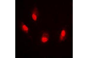Immunofluorescent analysis of Histone H4 (AcK8) staining in HeLa cells. (Histone H4 anticorps  (acLys8, N-Term))