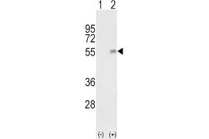 Western Blotting (WB) image for anti-Haptoglobin (HP) antibody (ABIN3003969)
