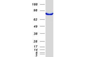 Validation with Western Blot