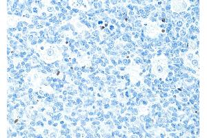 Immunohistochemistry (IHC) image for anti-Poly (ADP-Ribose) Polymerase 1 (PARP1) (AA 215-265) antibody (ABIN7455116) (Recombinant PARP1 anticorps  (AA 215-265))