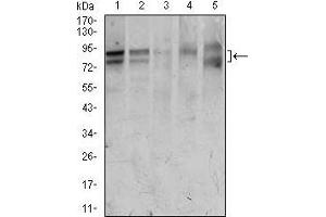 Western blot analysis using FOXP1 mouse mAb against HeLa (1), Jurkat (2), MCF-7 (3), T47D (4), and Raw264.